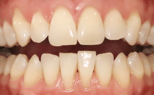 Before
